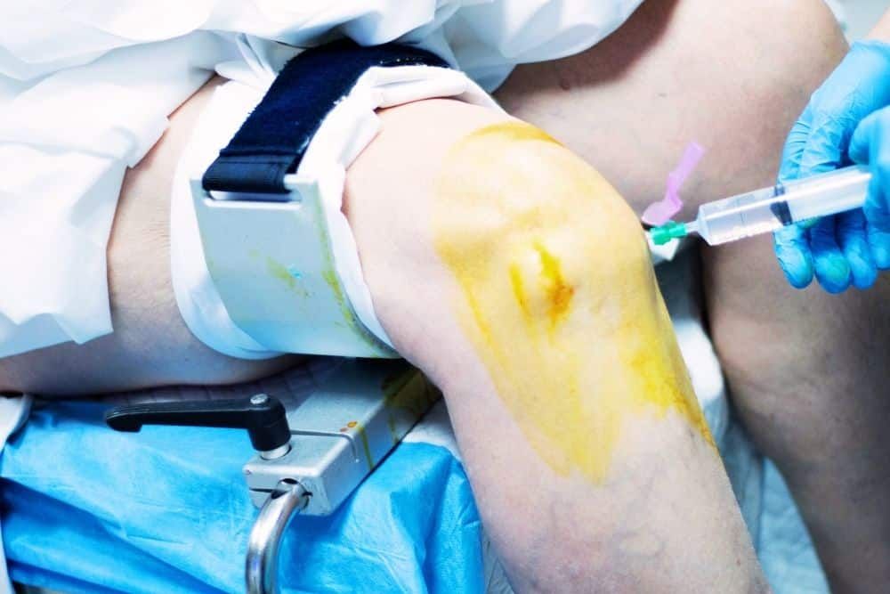 Rehabilitación de rodilla operada: claves para una recuperación eficaz | Clínica Recupérate en Salamanca