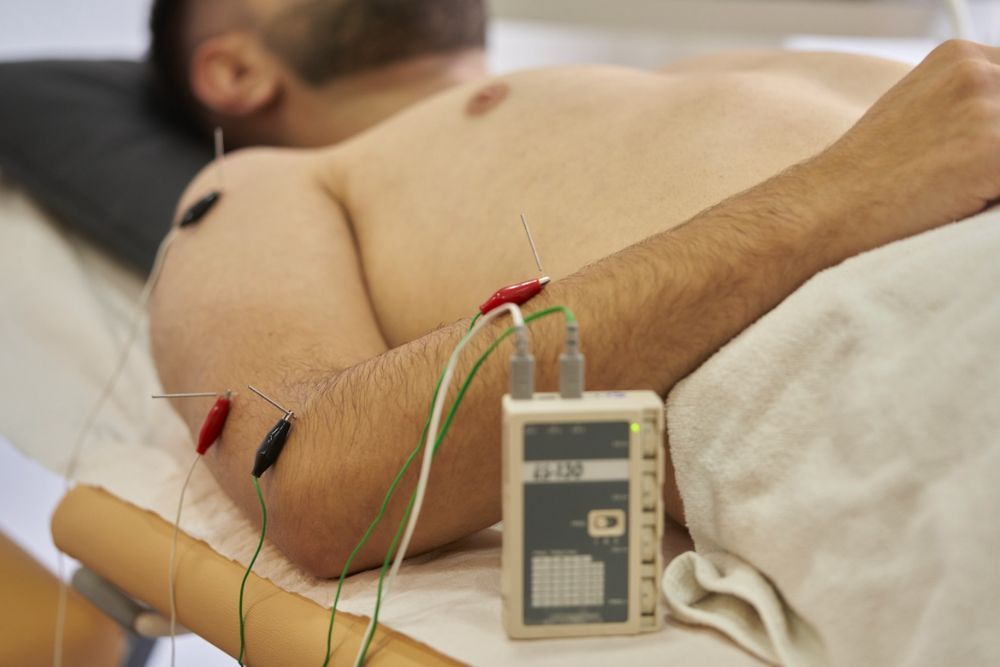 Neuromodulación percutánea ecoguiada en Salamanca — electroestimulación