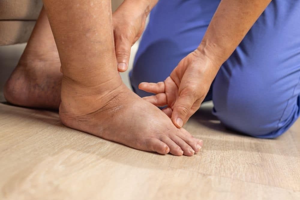 Edema óseo persistente: causas, síntomas y tratamiento con fisioterapia | Clínica Recupérate en Salamanca