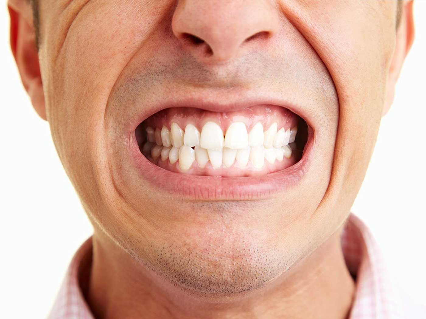 Si padeces bruxismo, ¿cómo puede ayudarte la fisioterapia? | Clínica Recupérate en Salamanca