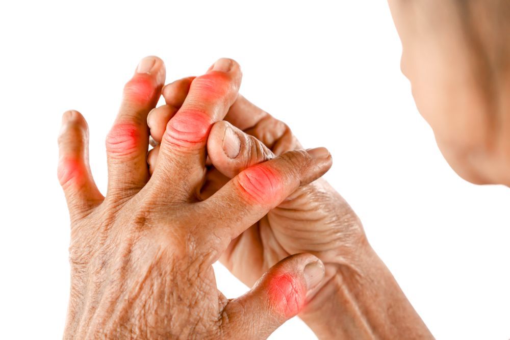 ¿Es bueno andar para la artritis? | Clínica Recupérate en Salamanca