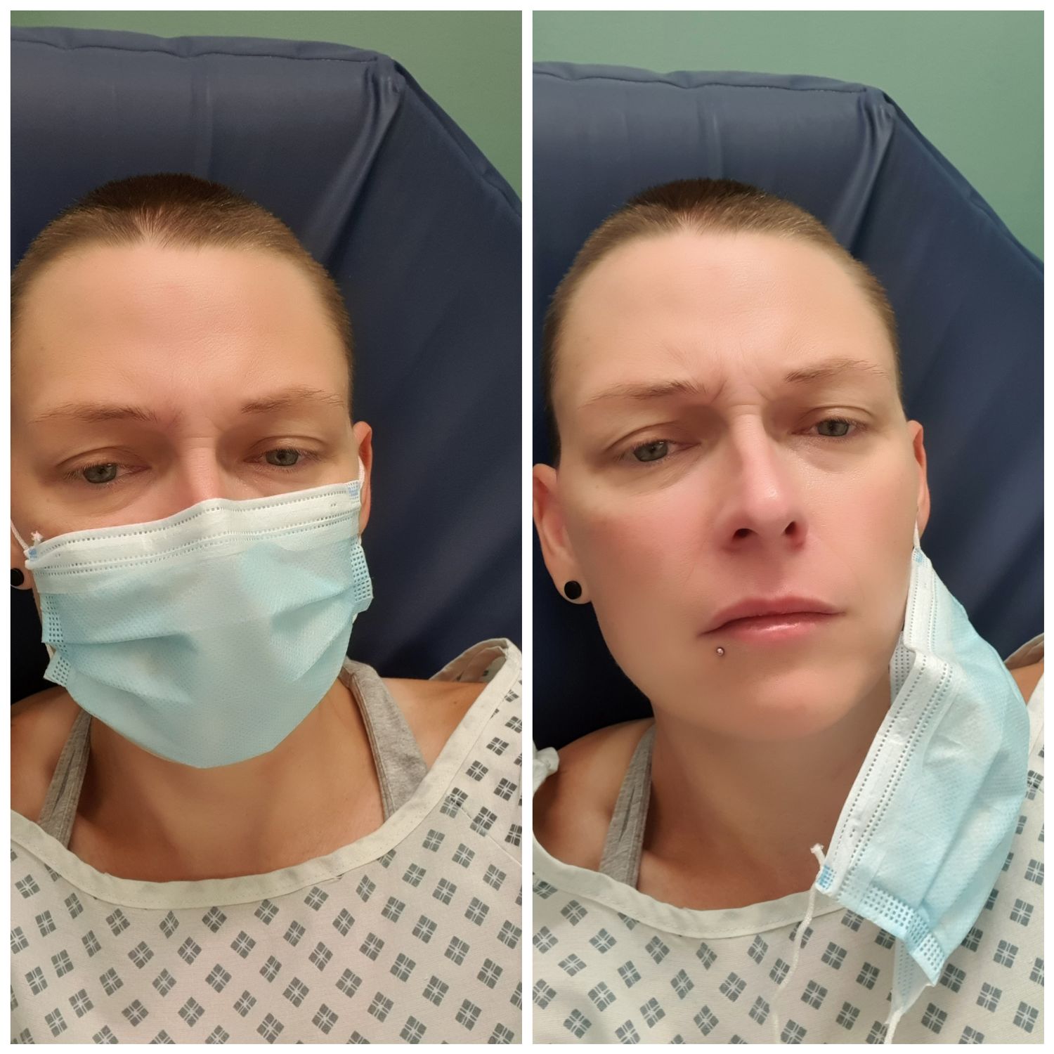 Me in A&E. Not looking too happy!