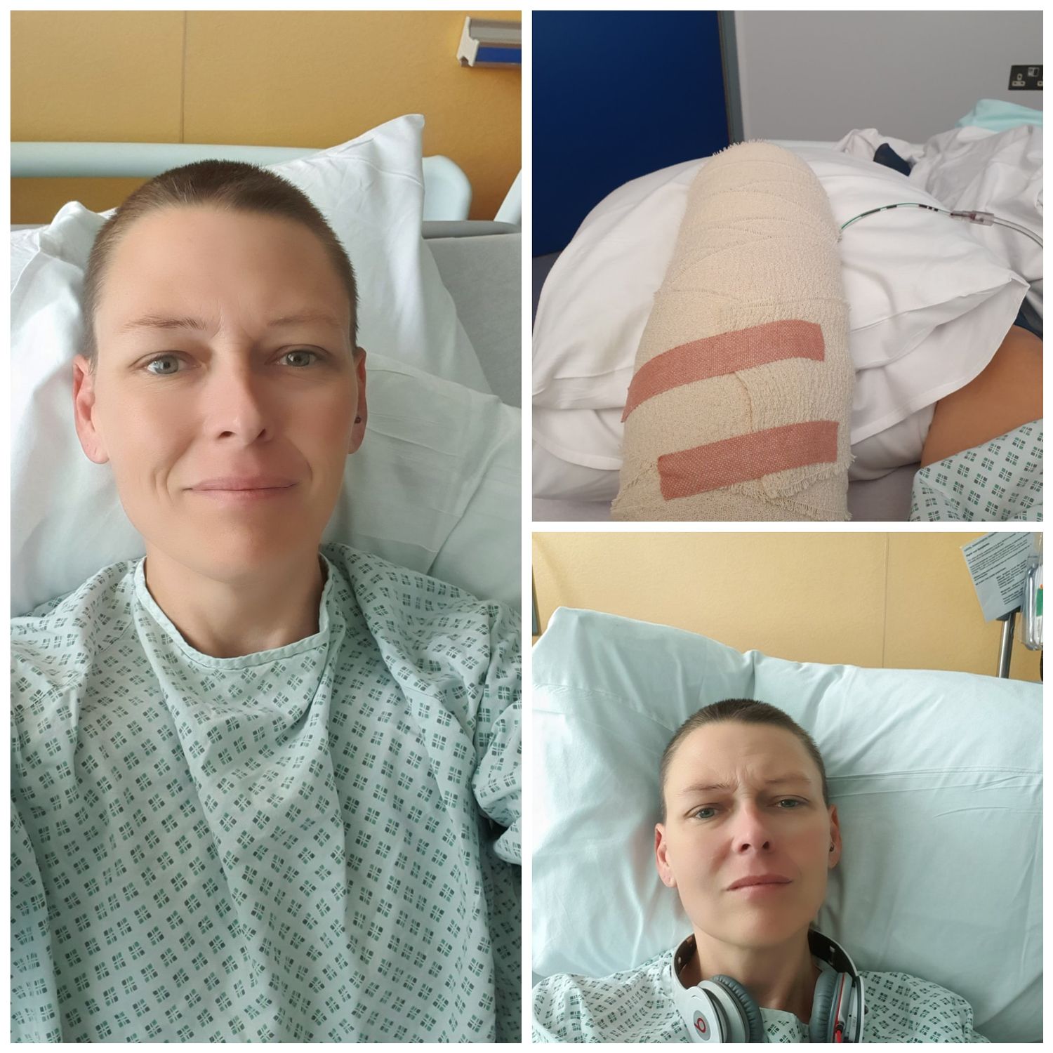 Pre and post op