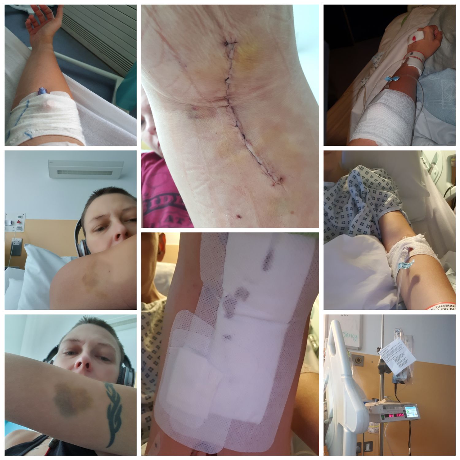 Battered and bruised!!