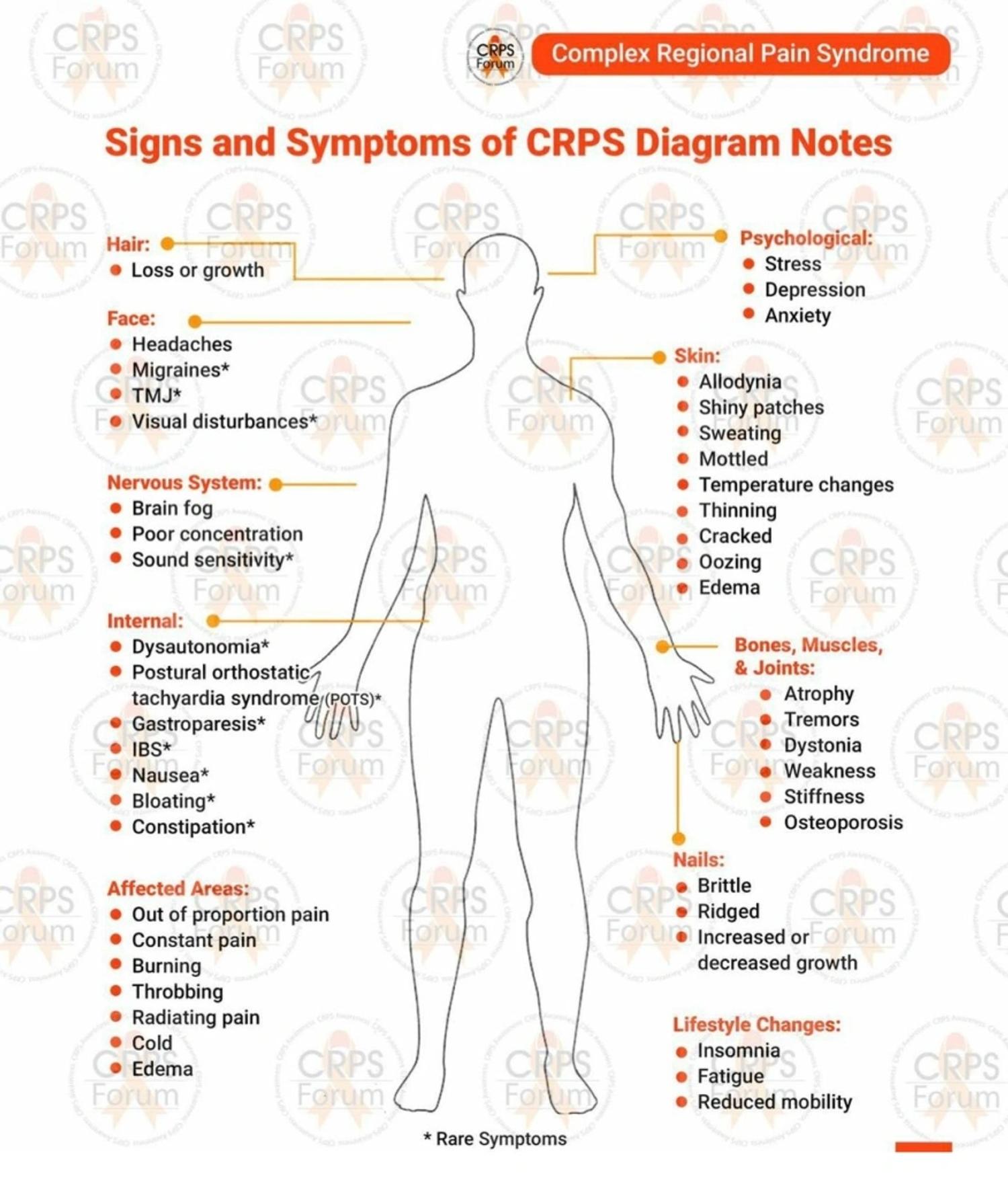 Symptoms of CRPS.