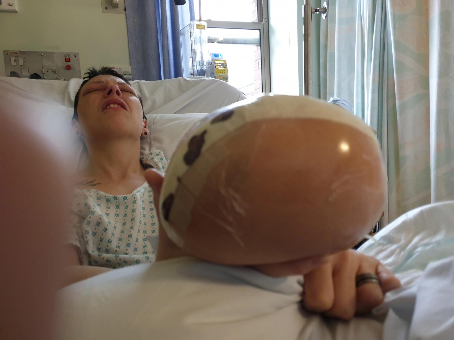 Not too flatering, but this was when I was in alot of pain!