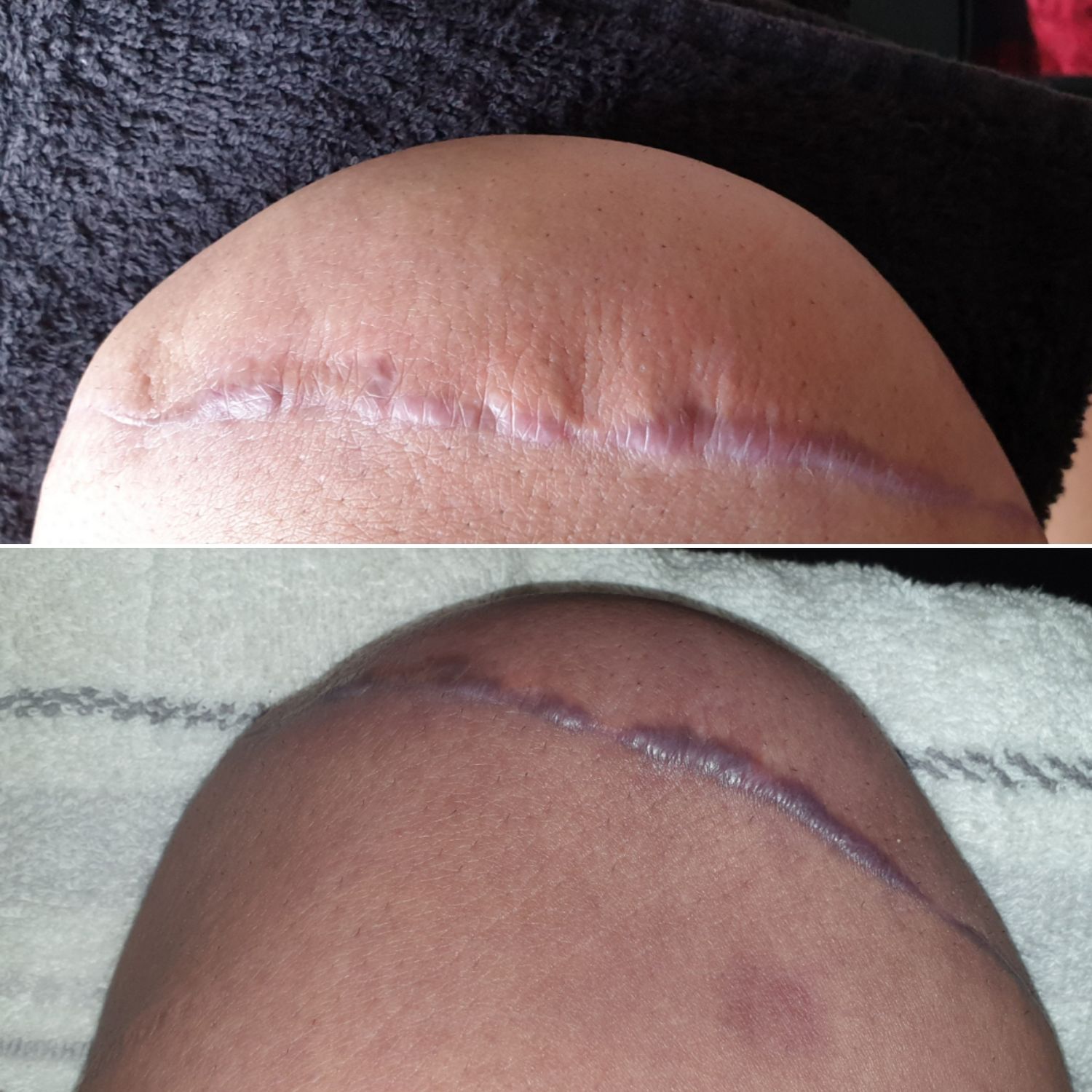 Top pic is stumpey normal colour, bottom is its other colour!