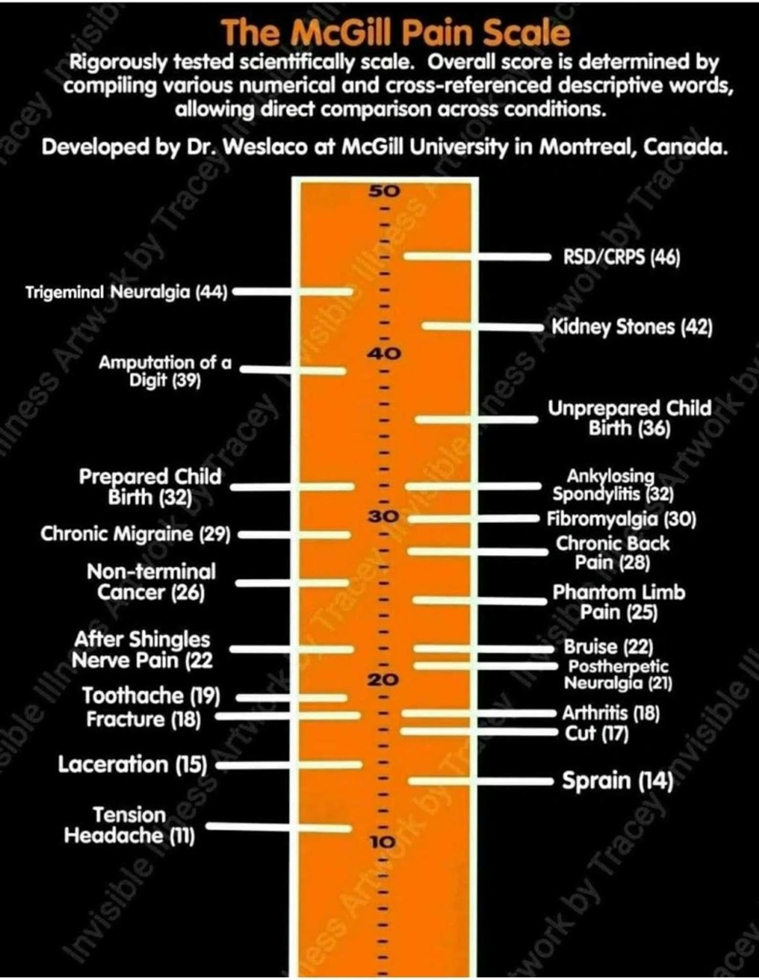 This simply shows where CRPS sits amongst other pain conditions. Enough said!