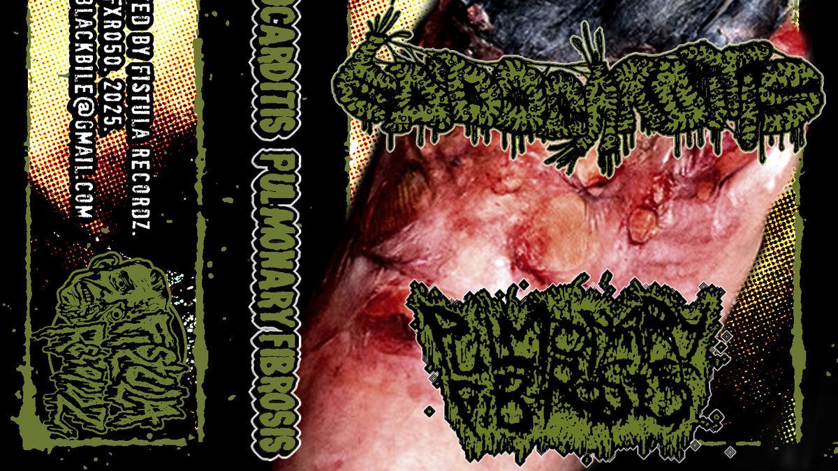Image pour l'article Split 5 titres du groupe de goregrind Endocarditis