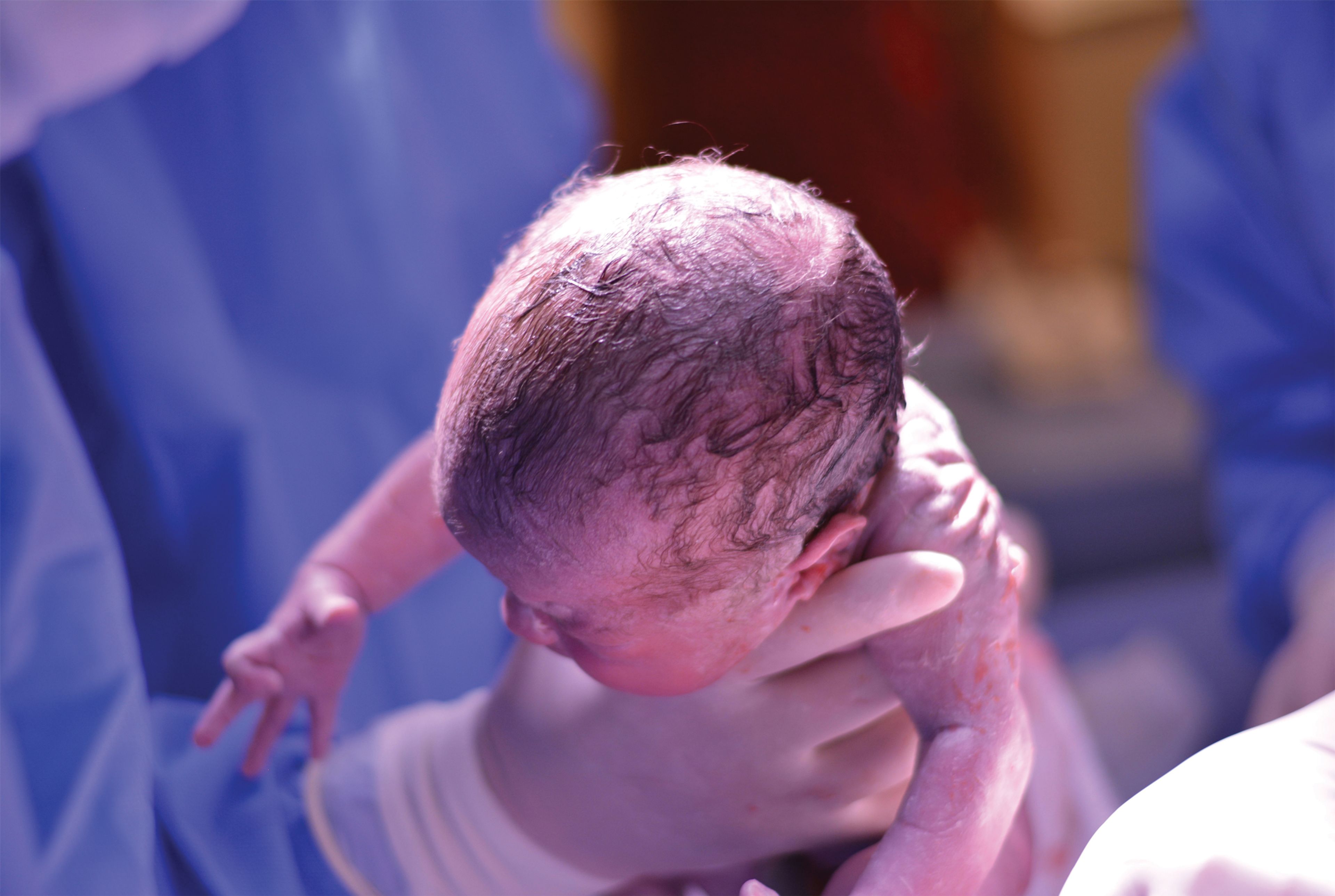 Photo for an article about children born small for gestational age