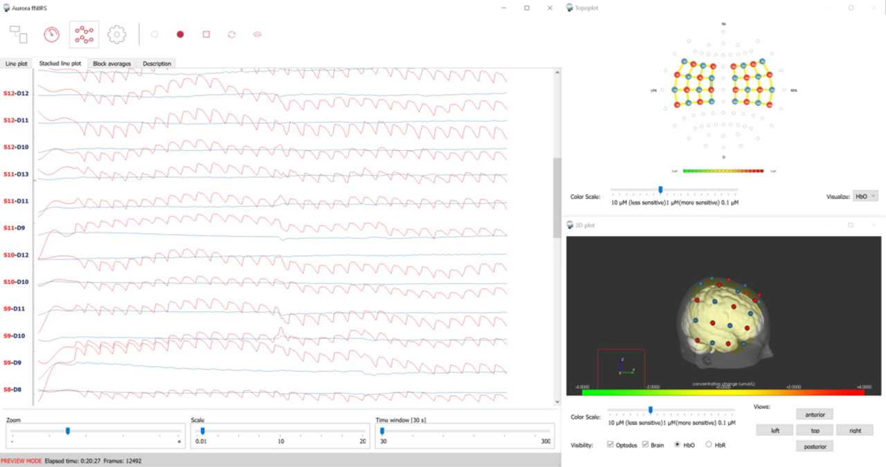 Software di acquisizione Aurora