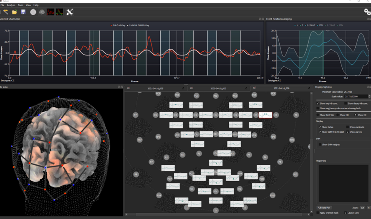 Software per l'analisi dati fNIRS - SATORI