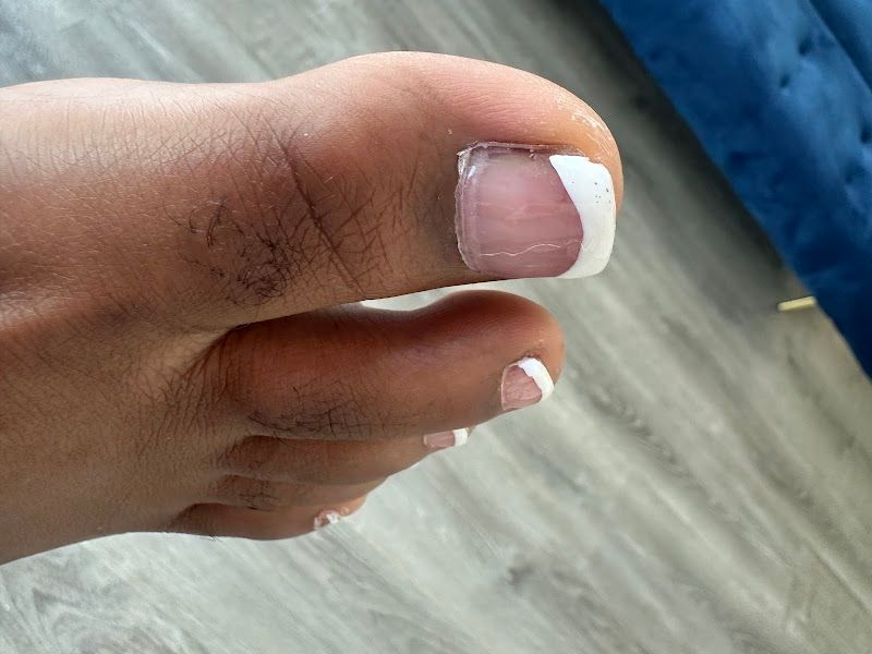 Nail Trip