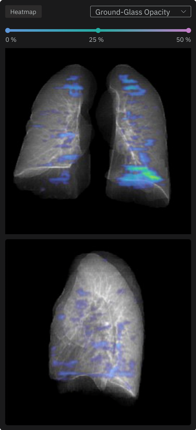Close up of the Heatmap Features, visualizing distribution of abnomalies
