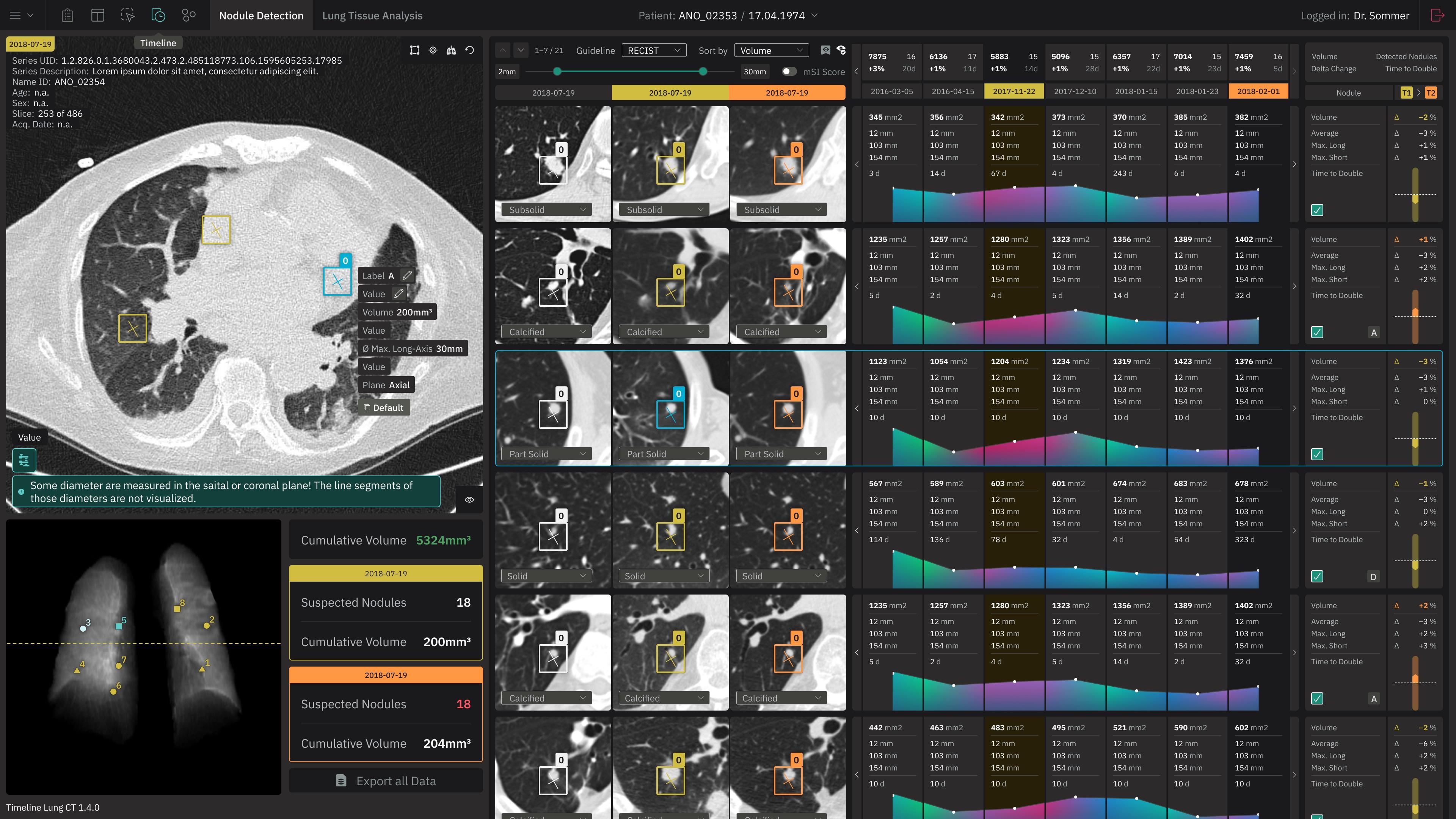 Complex user interface to analyze Lung CT scans