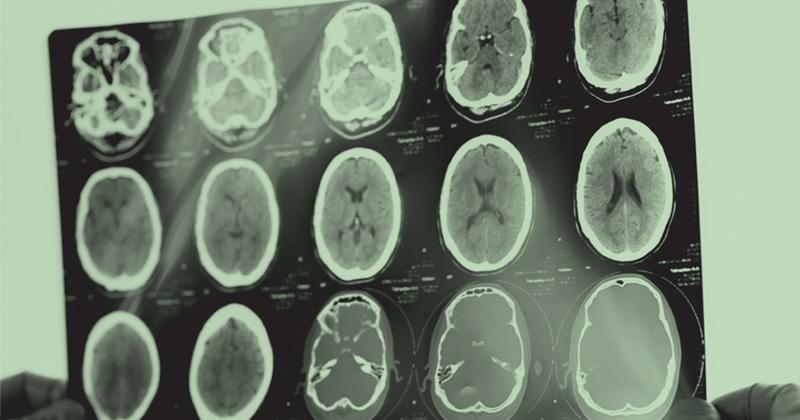 The New Startup Preventing Metabolic Dysfunction Through AI