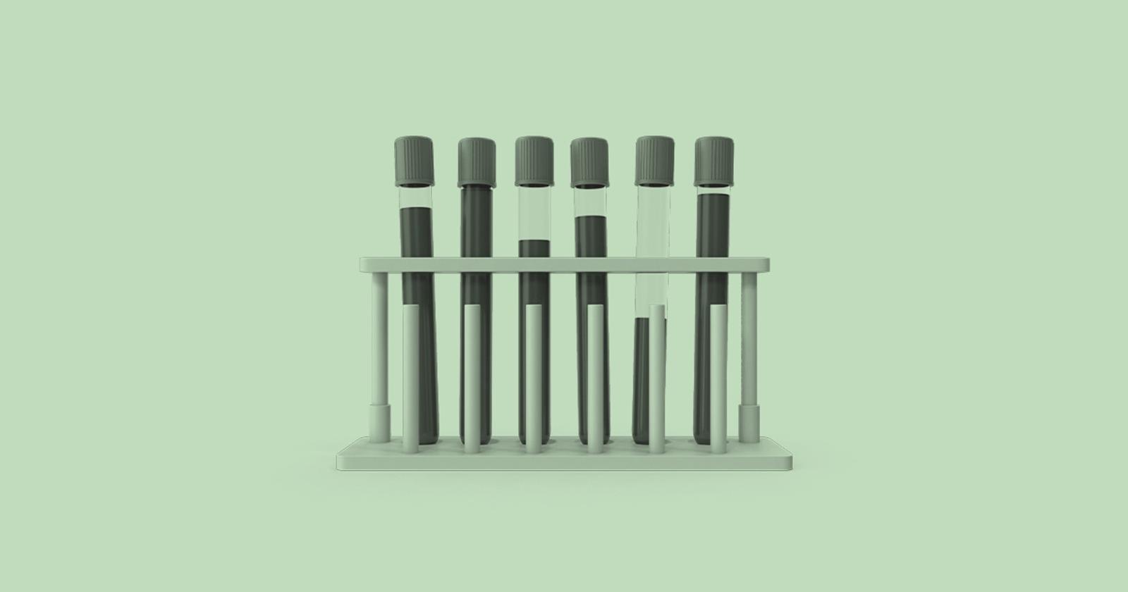Labcorp blood test