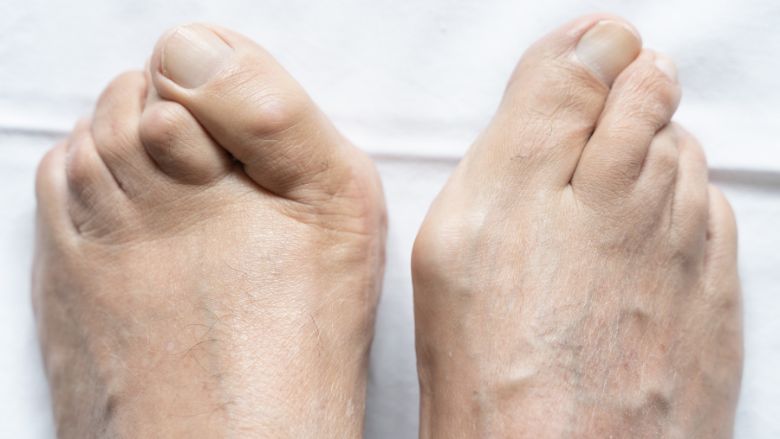 giày chạy bộ rộng mũi cho bàn chân bè
