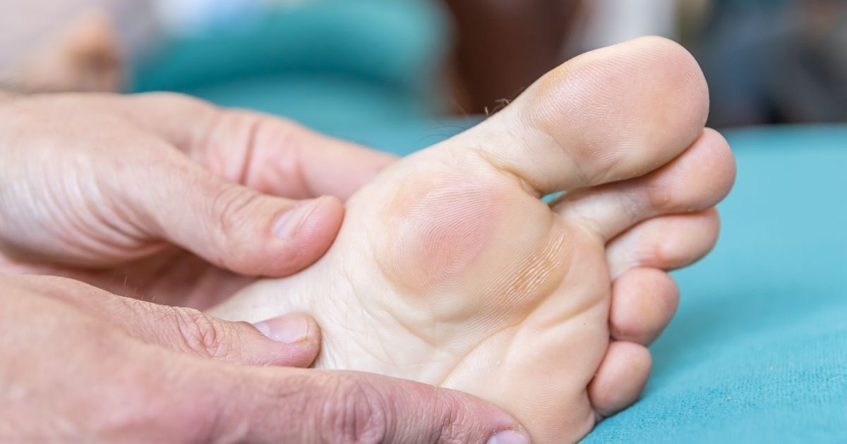 Đen móng chân và phòng rộp khi chạy: Nguyên nhân, cách phòng ngừa từ gốc và xử lý tại nhà
