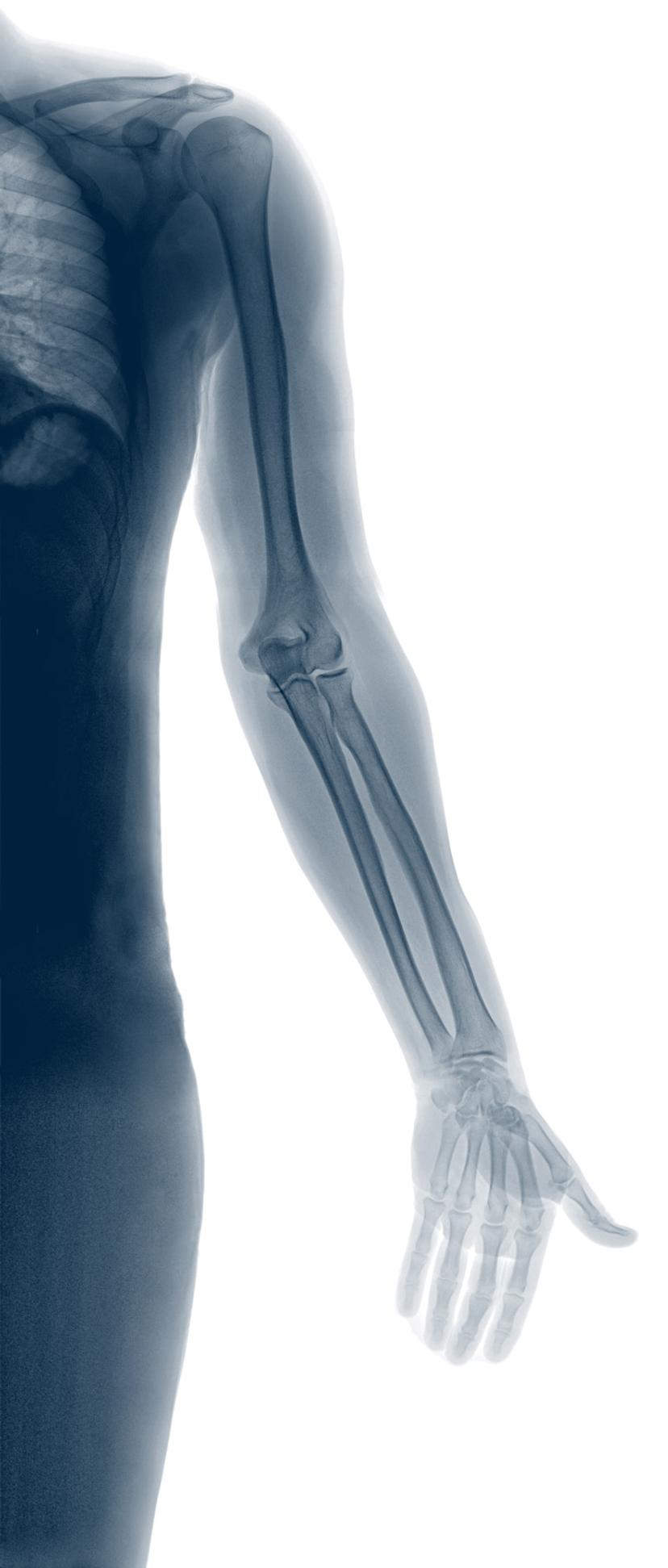 Bonebridge - The Swiss Medical Device Manufacturer