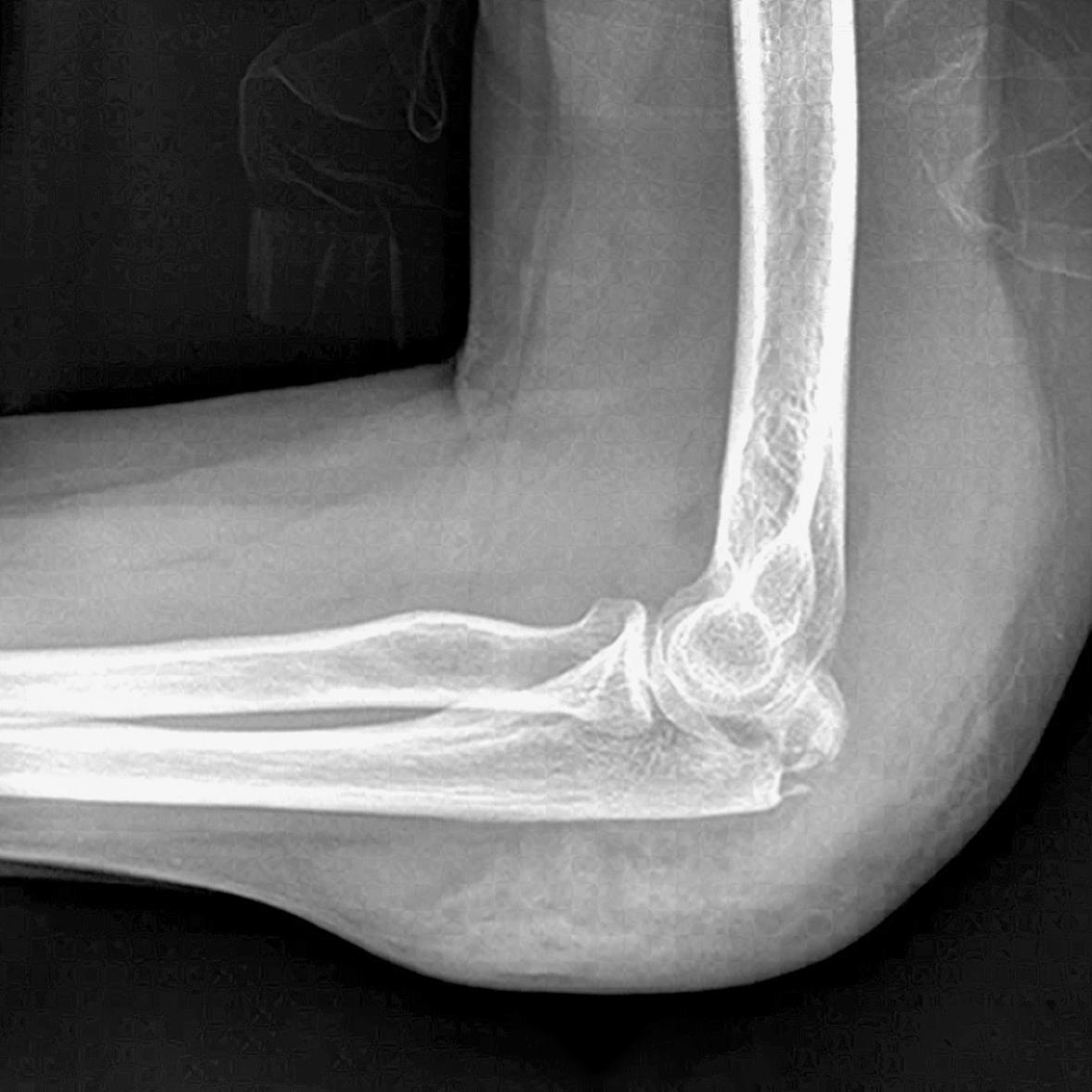 X-Ray LEPORELLO 2