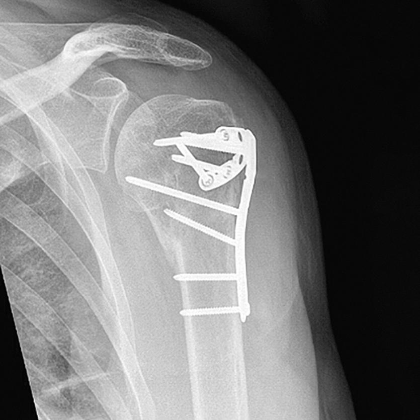 X-Ray TAMINA 5