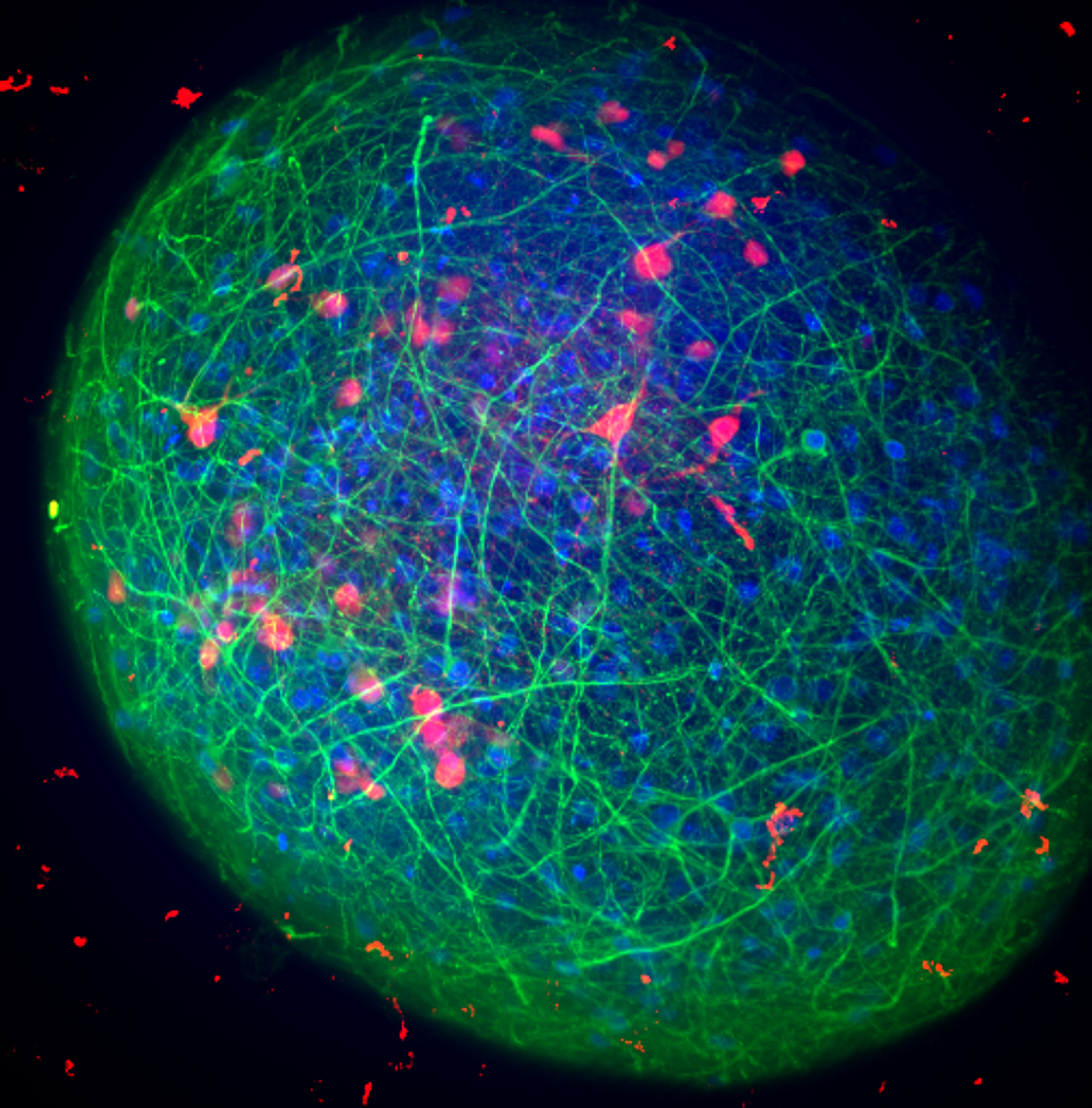 Mechanistic therapies for Alzheimer’s
