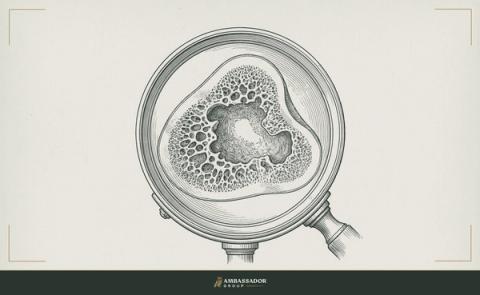 Antique engraving illustration. A bone cross-section at the center of the frame, its dense marrow structure visible under a magnifying glass, the truth of a thing found only beneath the surface layer.