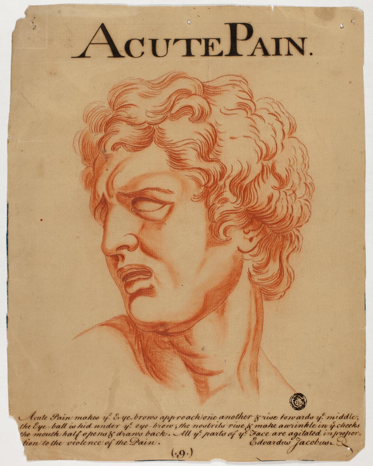 Acute Pain by Eduardus Jacobus