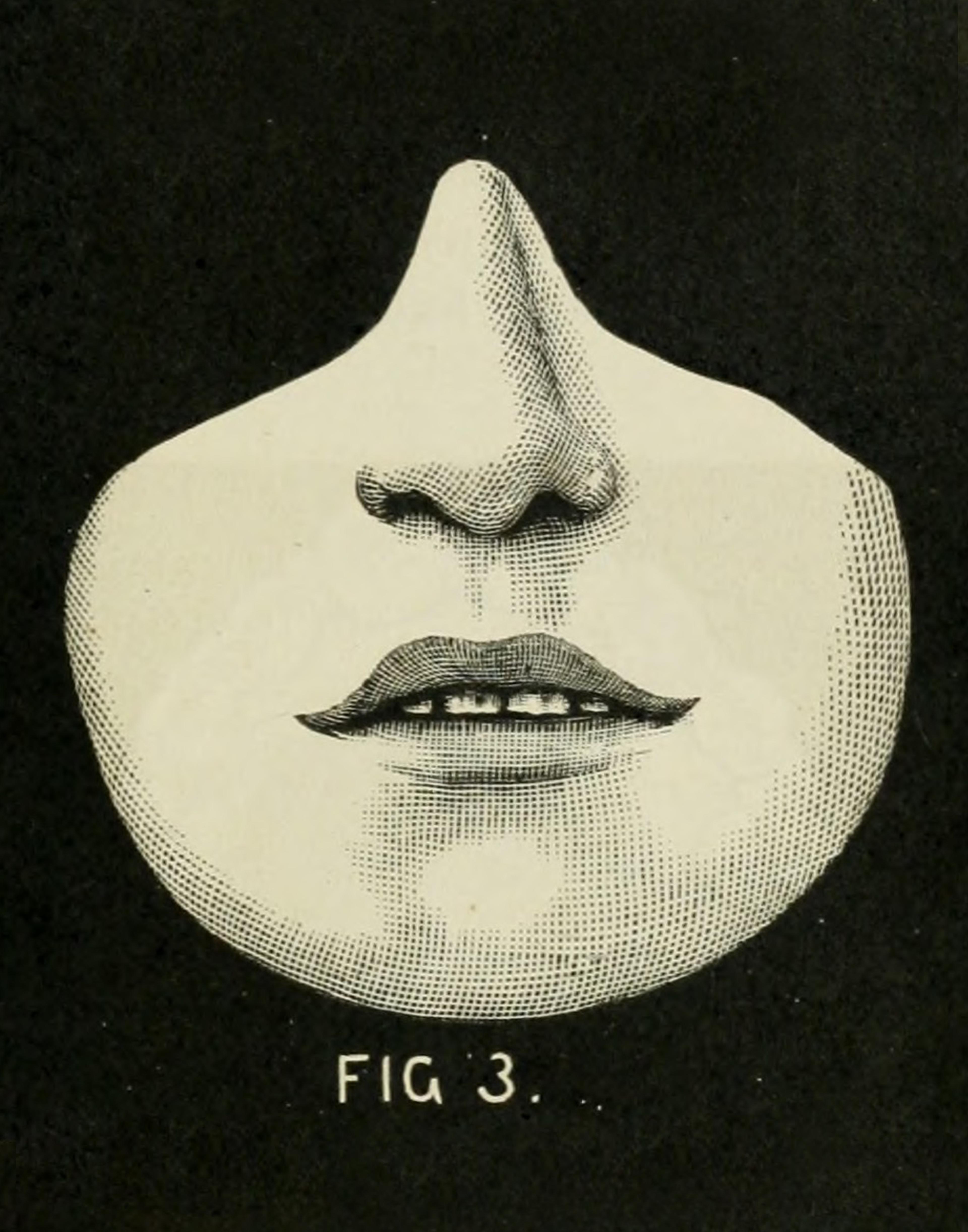 Mouth