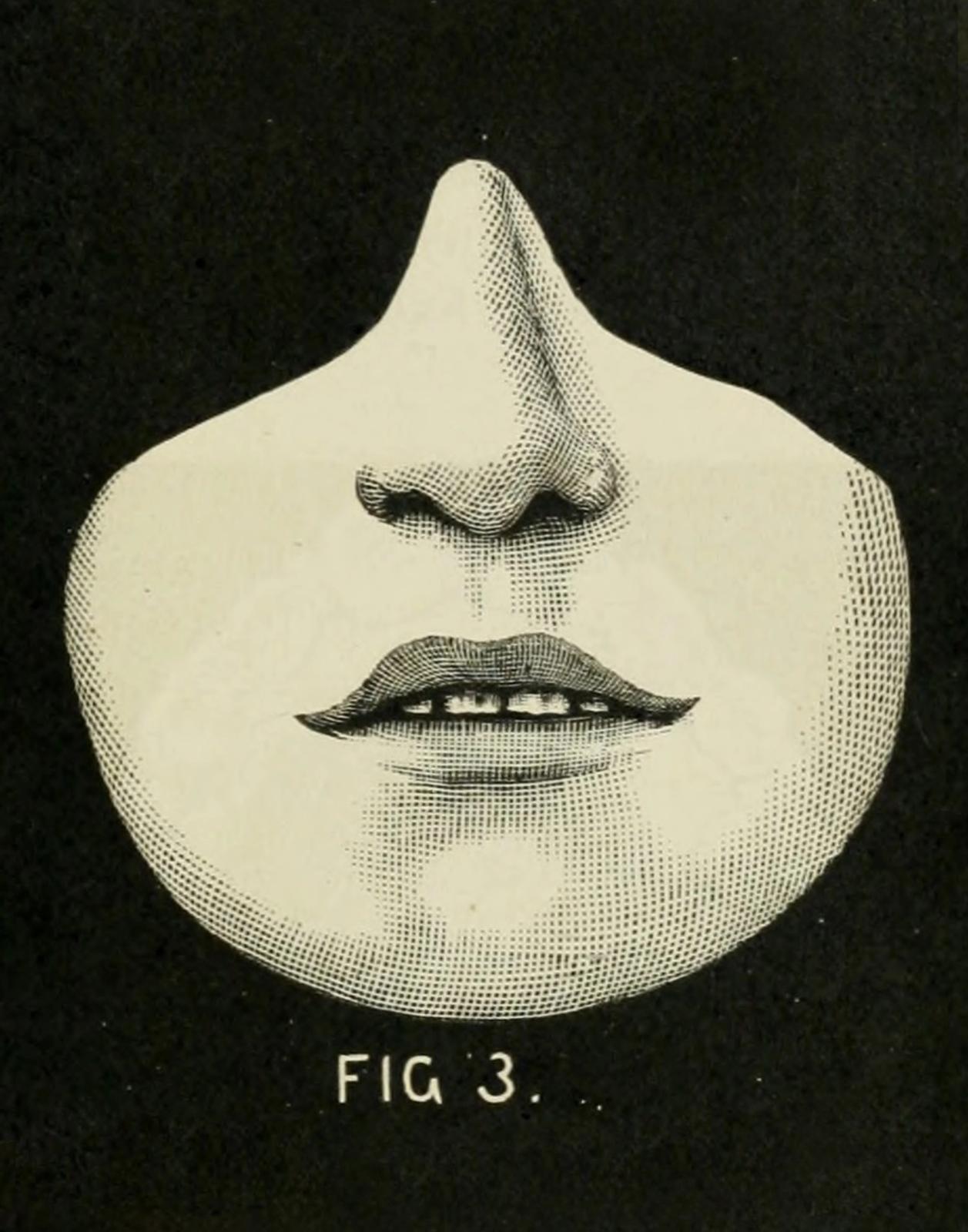 Vintage engraving of lower half of face showing nose and lips with crosshatch shading, labeled 'FIG 3'