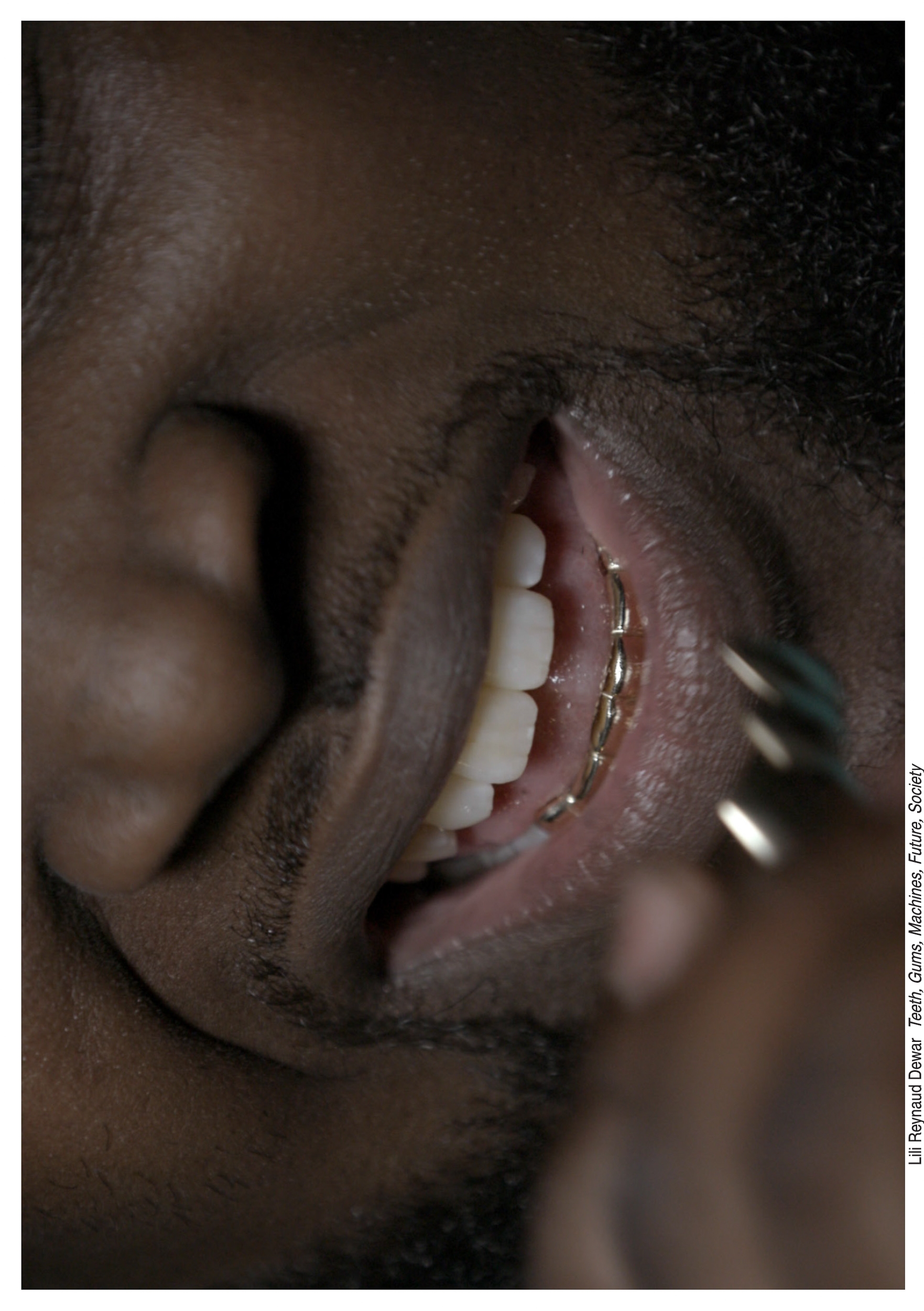 Invitation (back) | Teeth, Gums, Machines, Future, Society | Jungmyung Lee