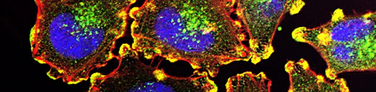 Global Pharmaceutical Company background