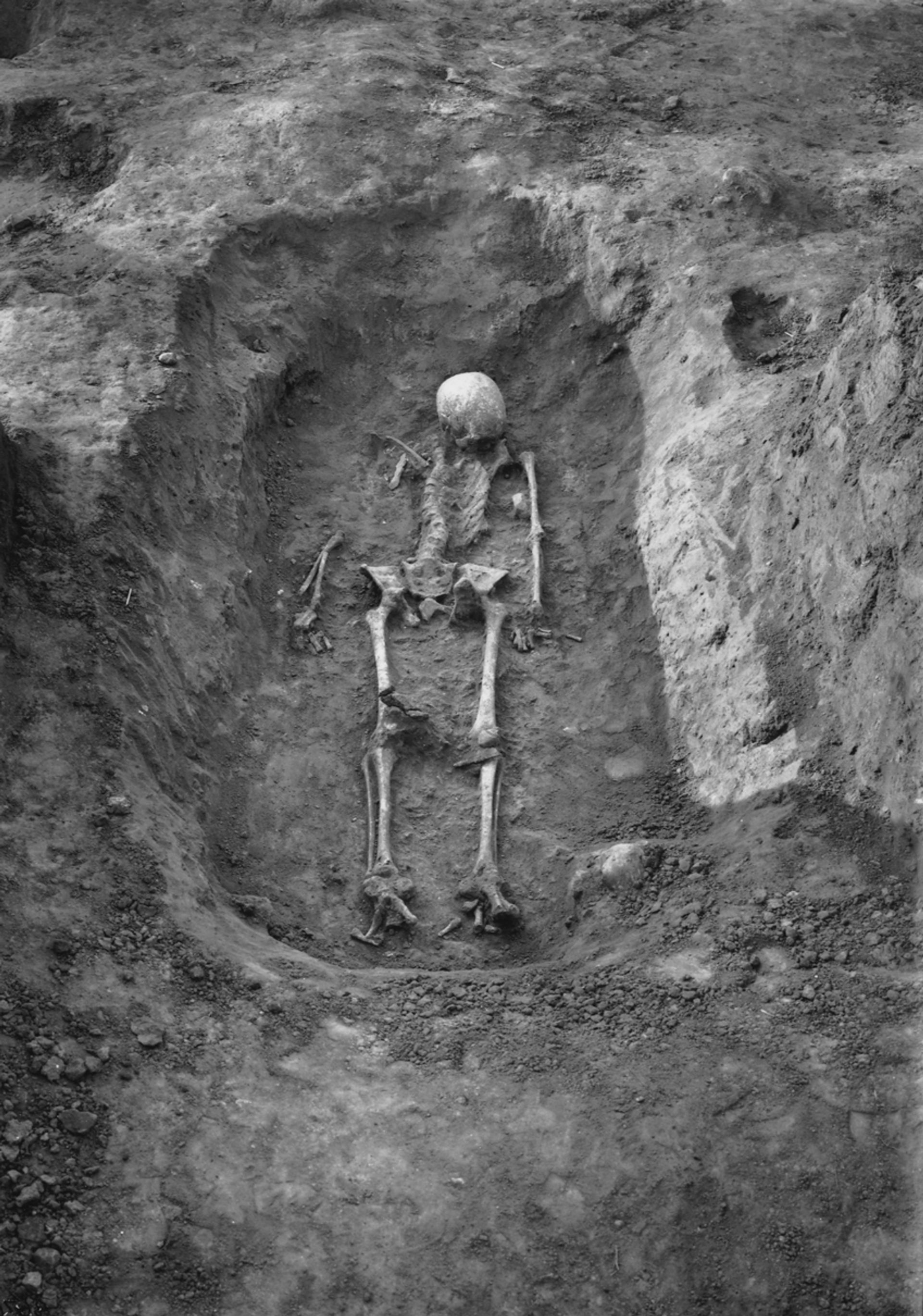 A skeleton lies dug up in the ground