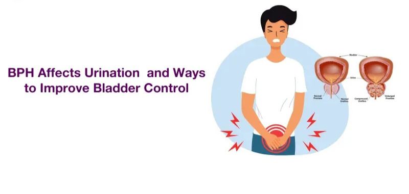 BPH Affects Urination