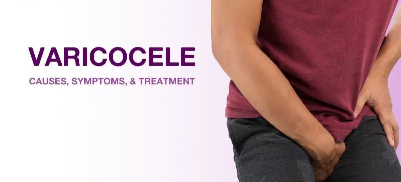 Varicocele Treatment