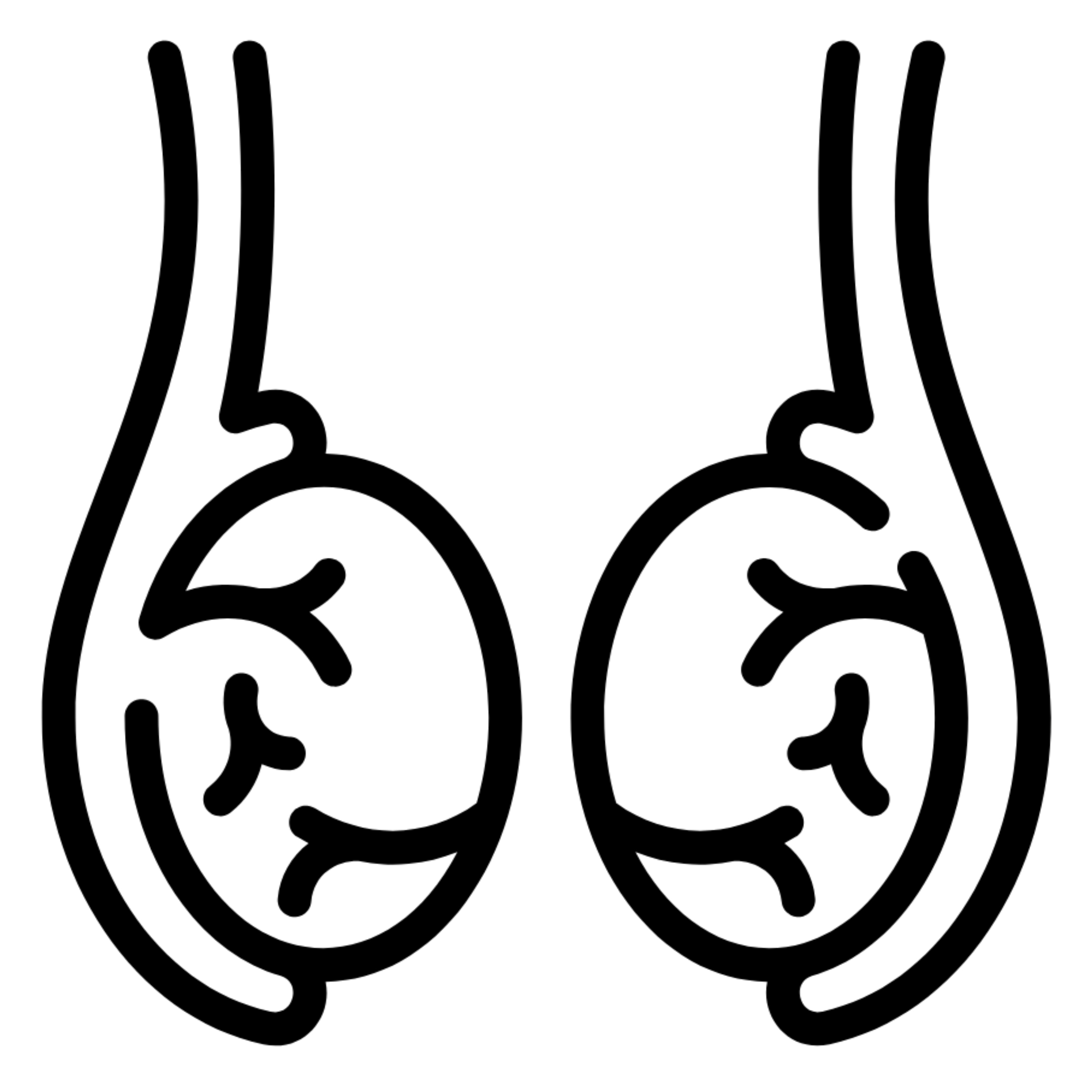 Hydrocele