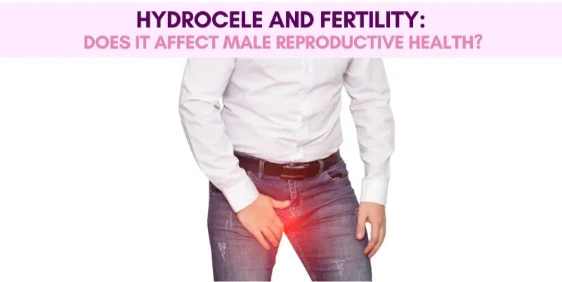 Hydrocele and Fertility
