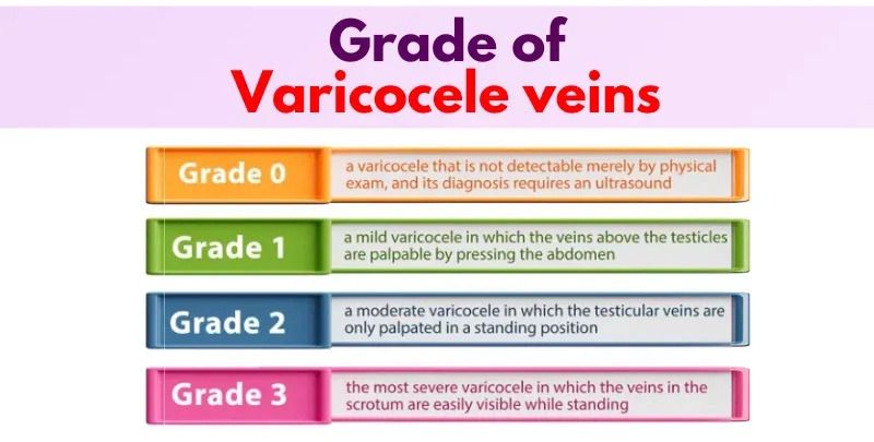 varicocele grading