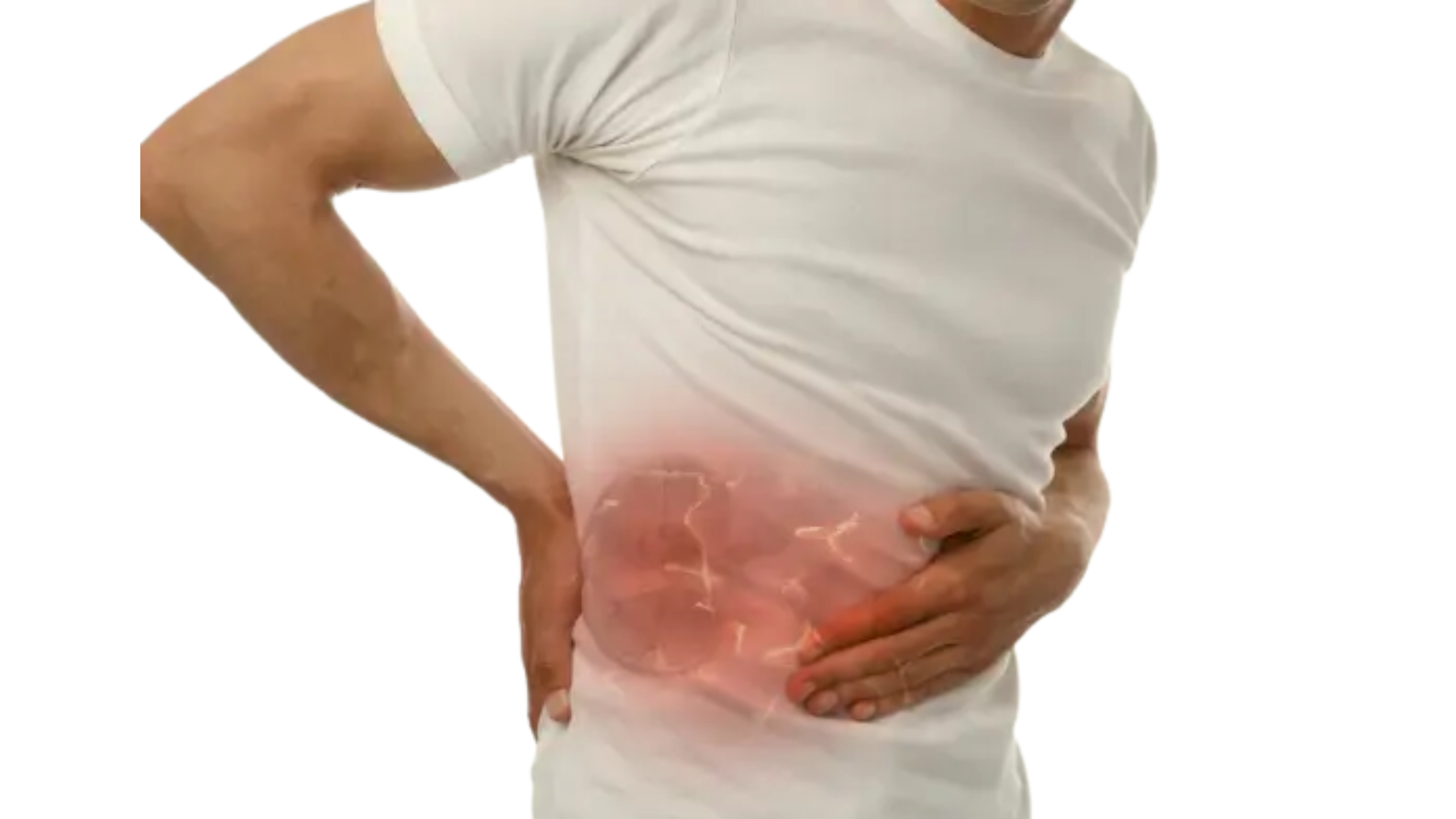 Retroperitoneal Fibrosis