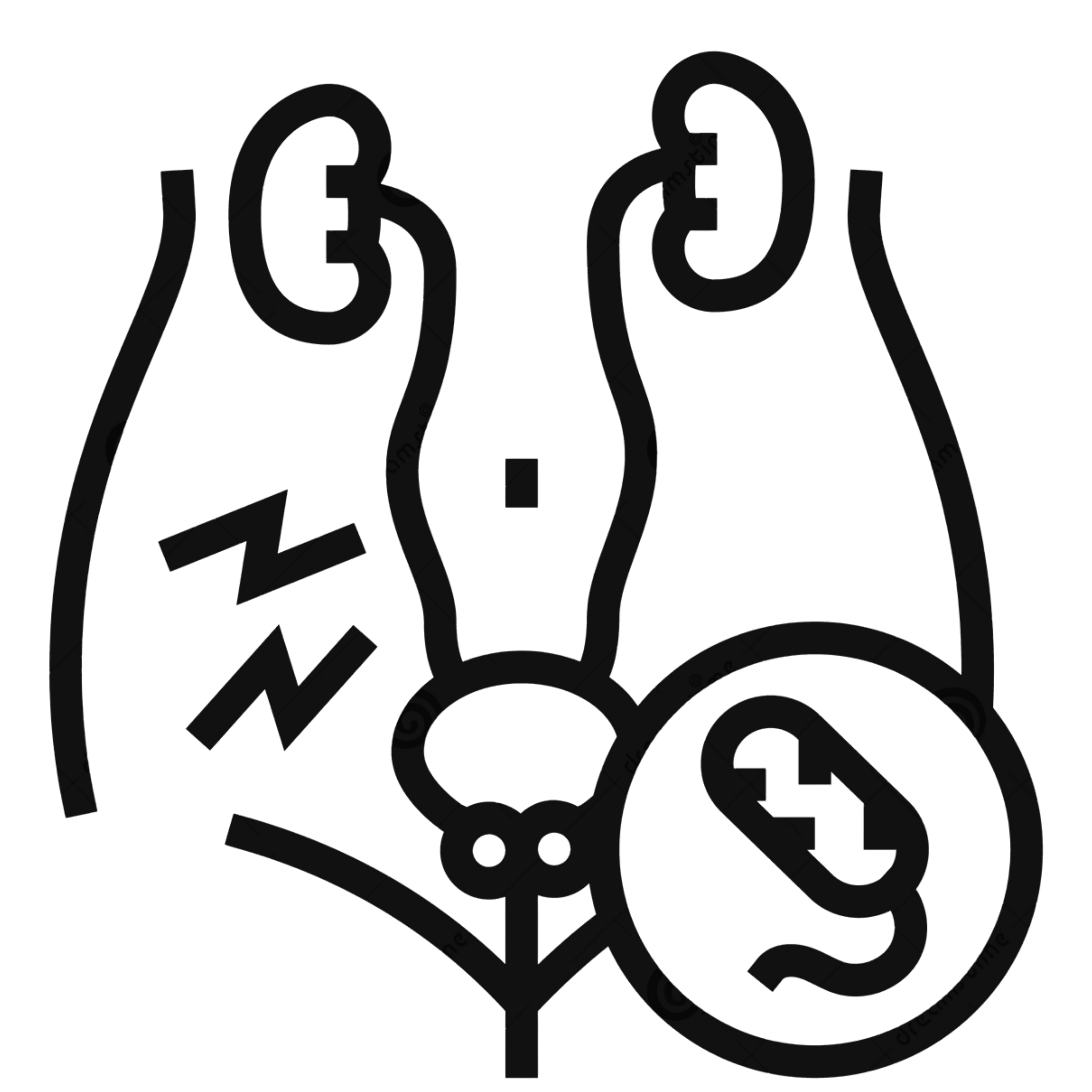 Urethritis