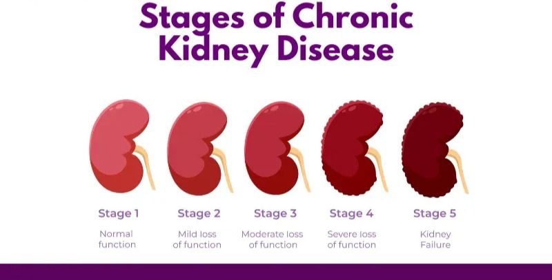 Chronic Kidney Disease Management