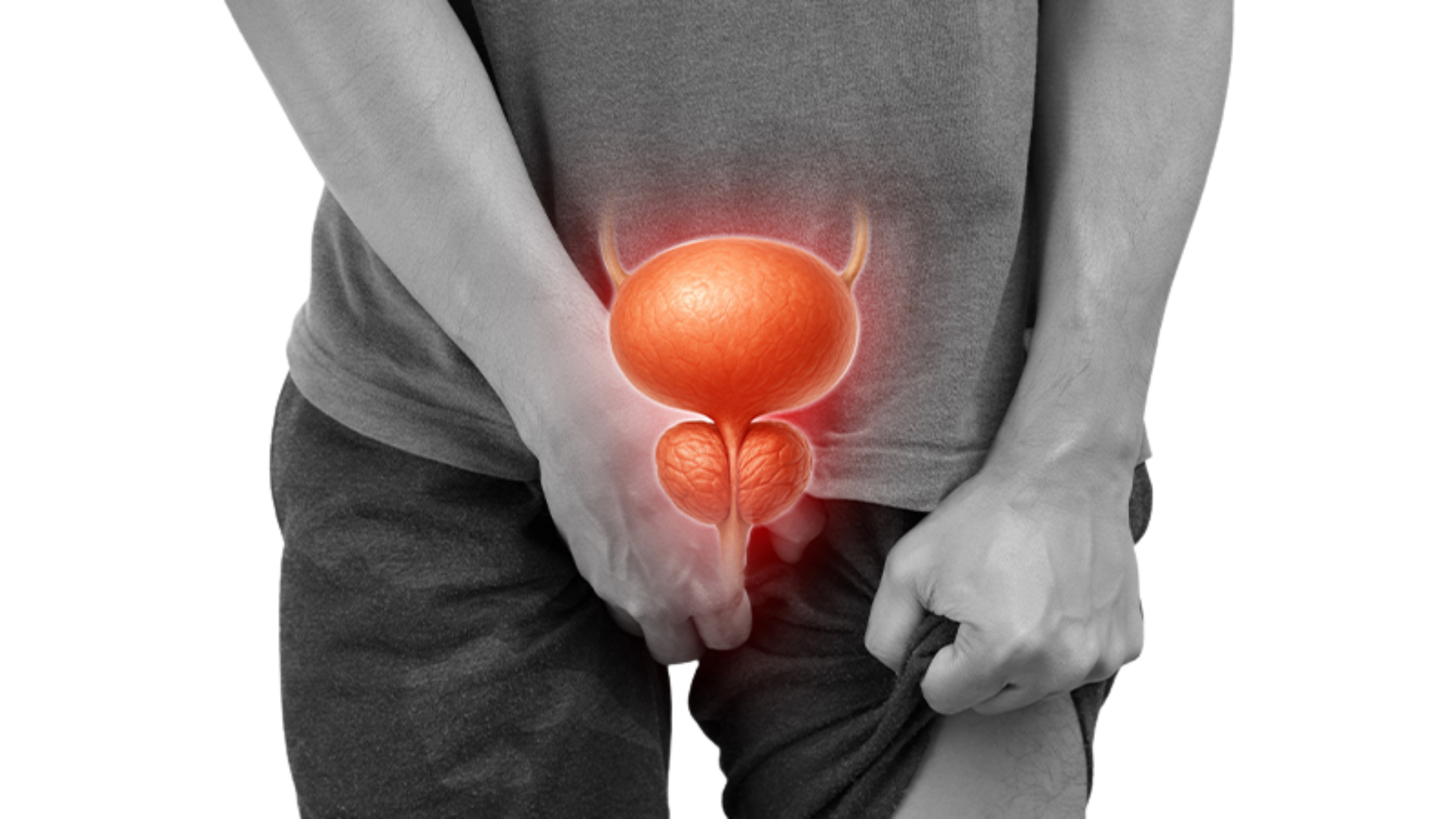 Enlarged Prostate