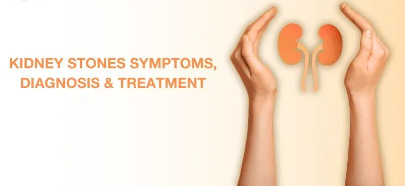 Best Urologist in Hyderabad for Kidney Stones