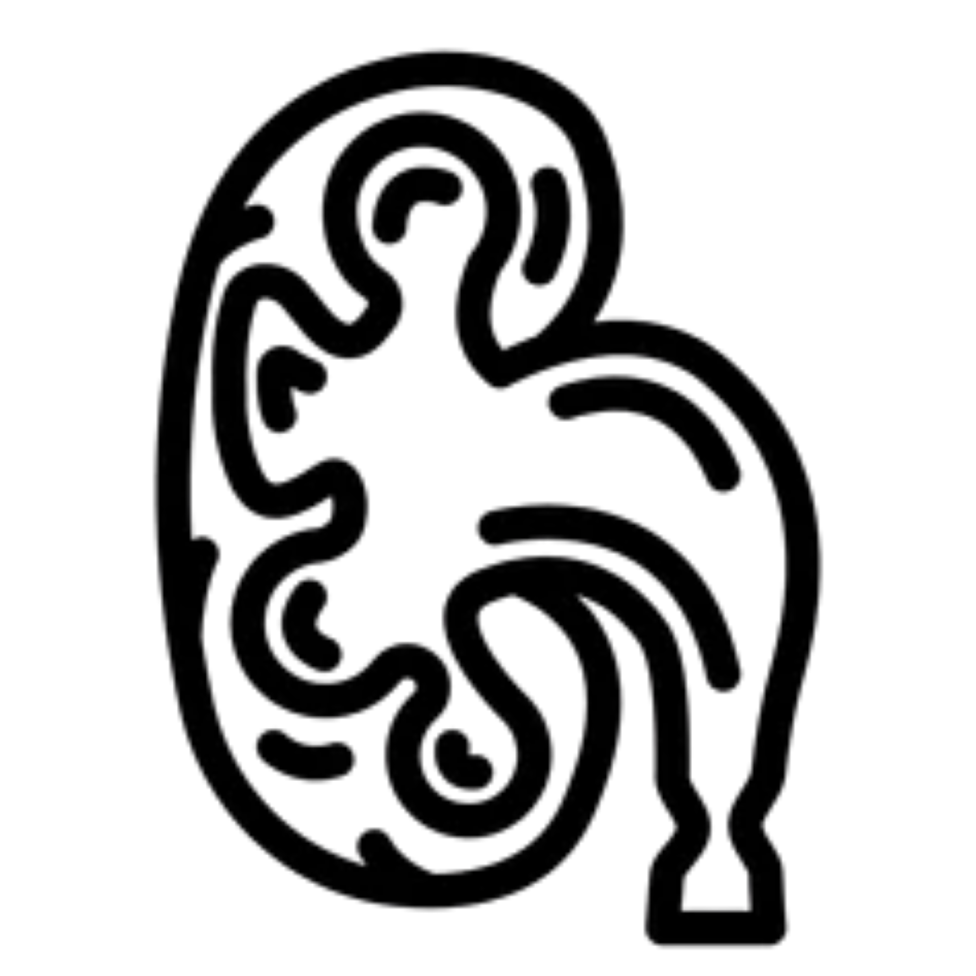 Hydronephrosis