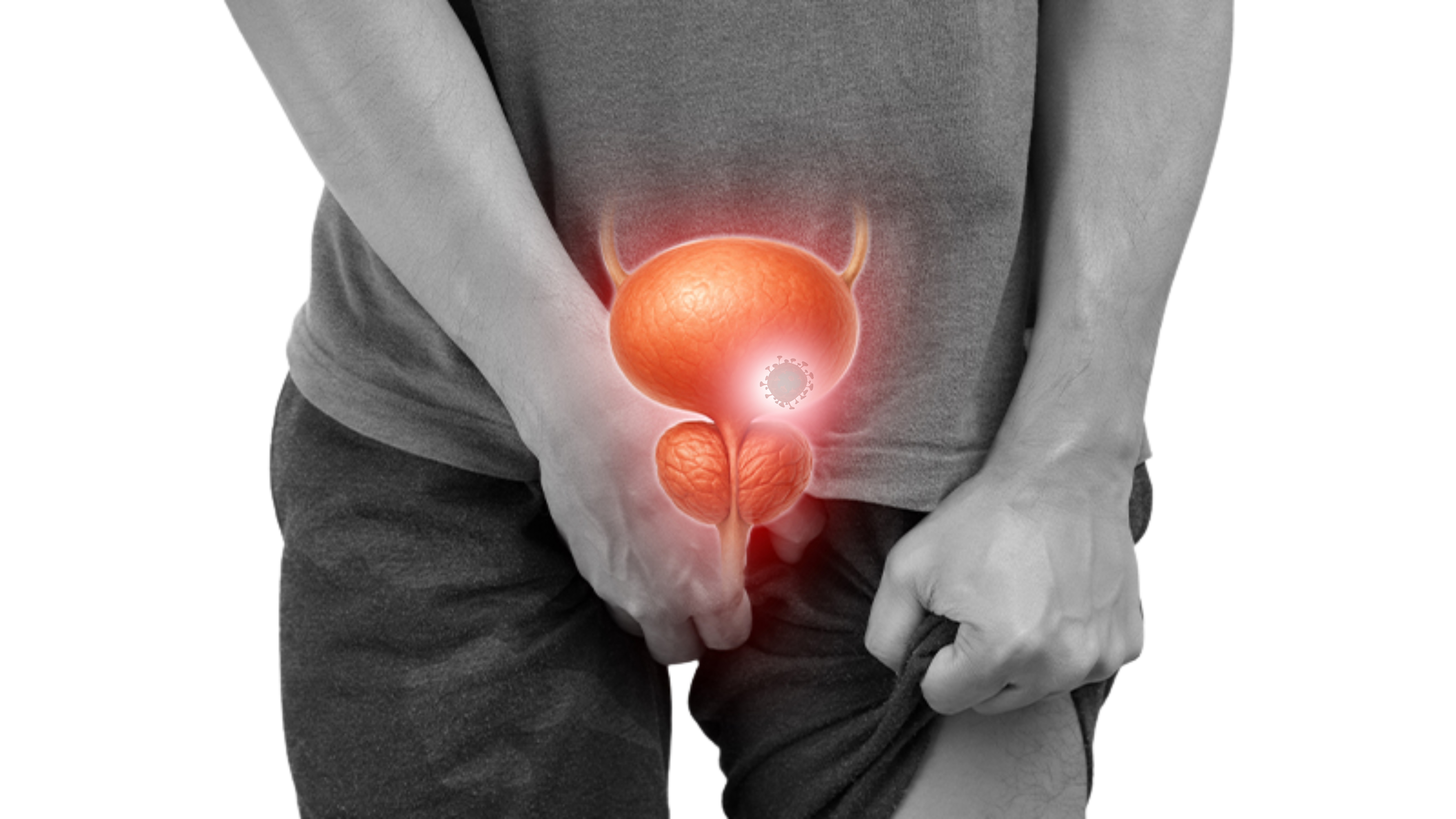 Prostate Cancer