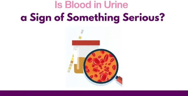 Blood in urine