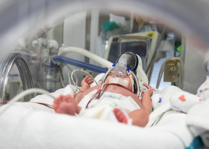A premature baby in Mount Sinai's neonatal intensive care unit.