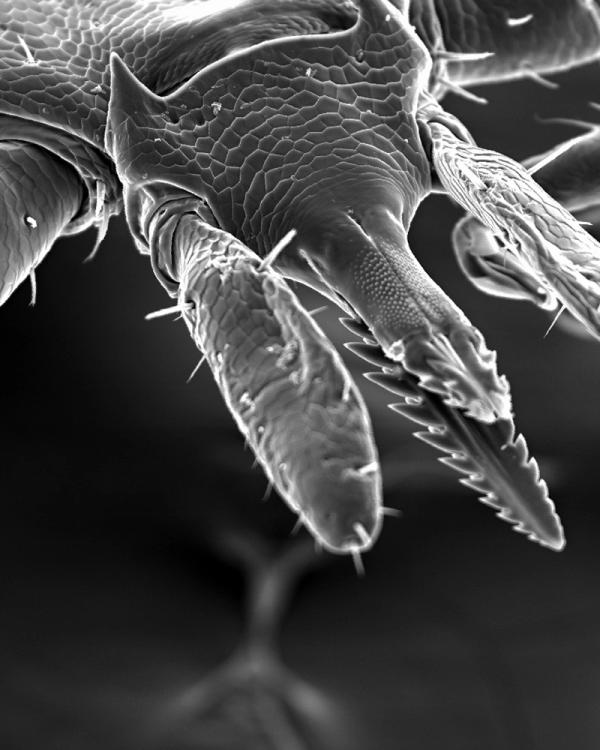 an Ixodes scapularis nymph, highlighting its mouthparts—pedipalps and hypostome. These specialized appendages play a key role in attachment, feeding, and reproduction, while also housing sensory organs that help the tick navigate its environment.