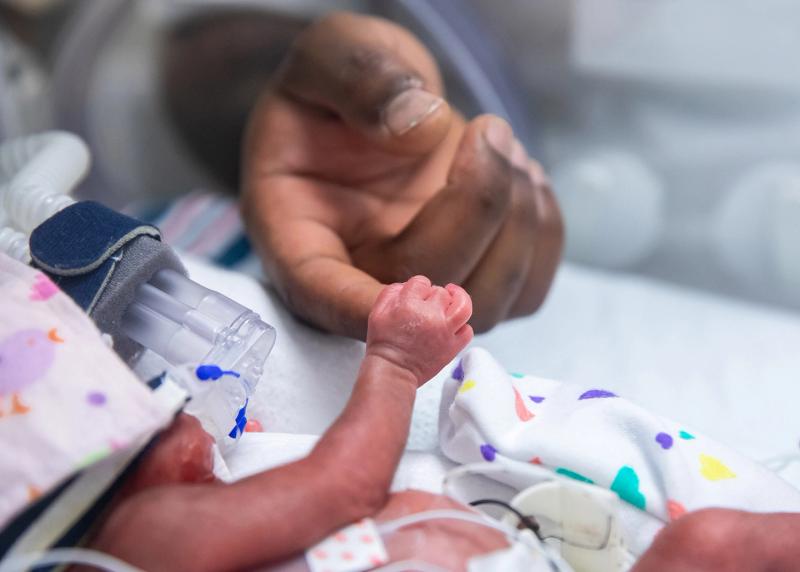 A premature baby in Mount Sinai's neonatal intensive care unit.